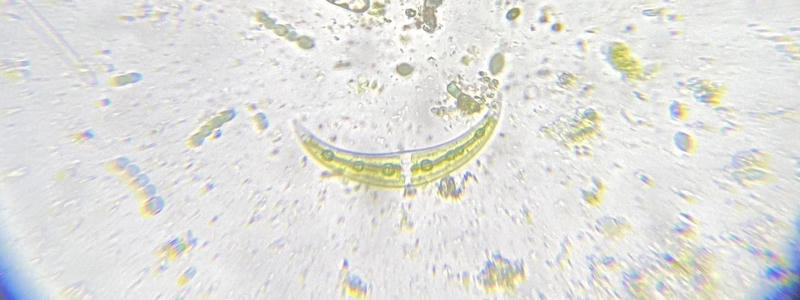 Closterium sp.