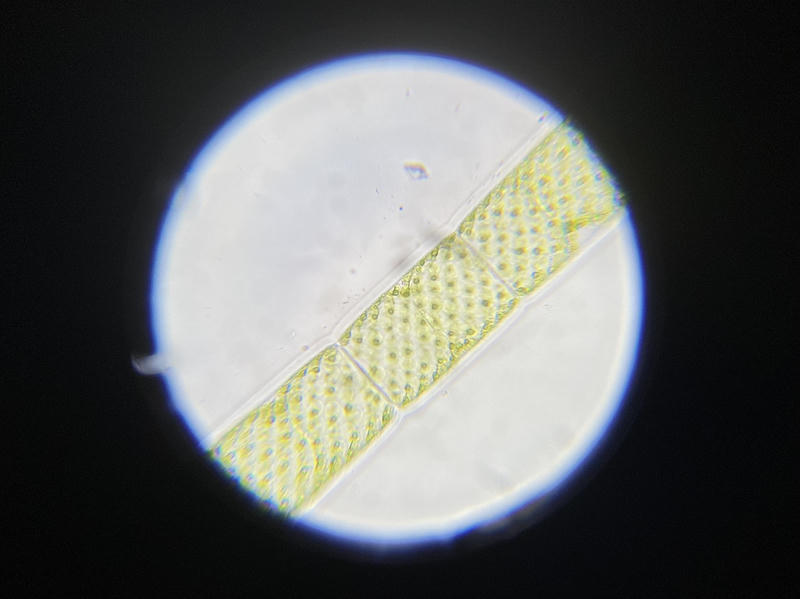 Spirogyra sp.