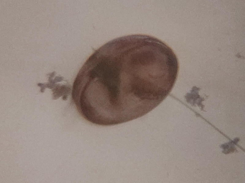 ออสตราคอส Ostracod